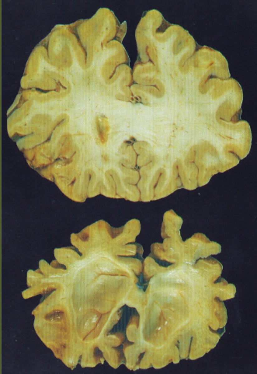 <p>1. Emotions</p><p>2. Behavior</p><p>3. Judgment</p><p>4. Reasoning</p>