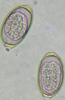 <p>The eggs in the accompanying image were seen on the fecal flotation of a beagle with occasional sneezing. The eggs measure approximately 65 micrometers. What is the diagnosis?</p>