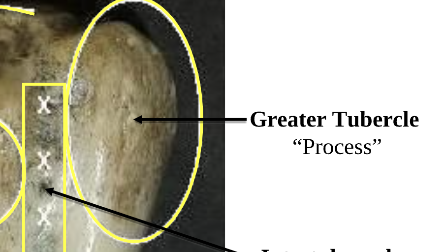 <p>Greater Tubercle  </p>