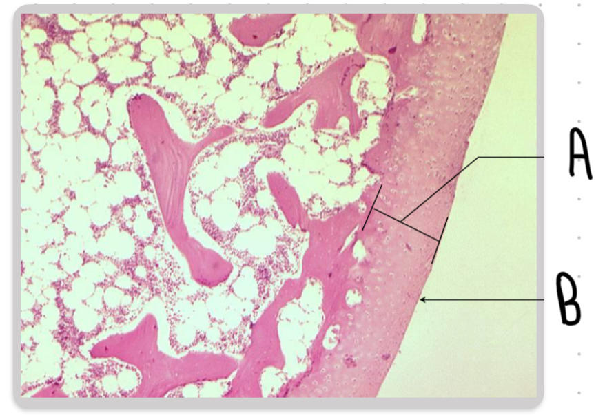 <p>What is the structure labeled A in this image?</p>