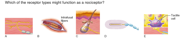 Which of the receptor types might function as a nociceptor?