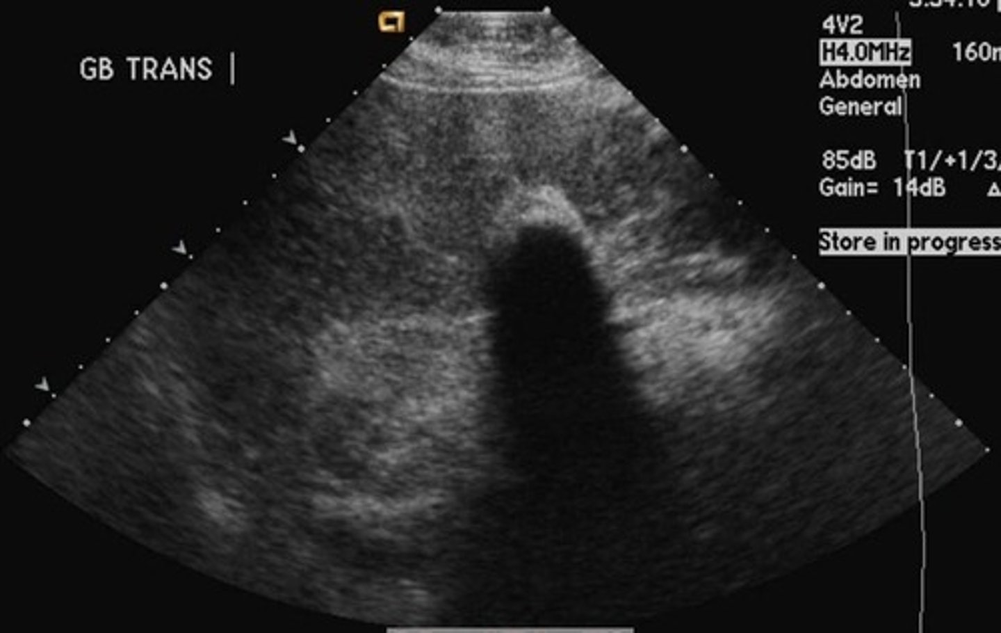 <p>wall echo shadow</p>