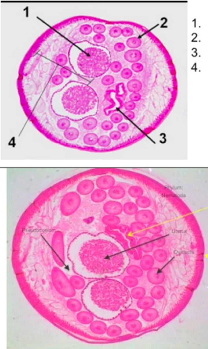 <p>Phylum Nematoda<br>1. uterus<br>2. oviducts<br>3. intestine<br>4. pseudocoelom</p>