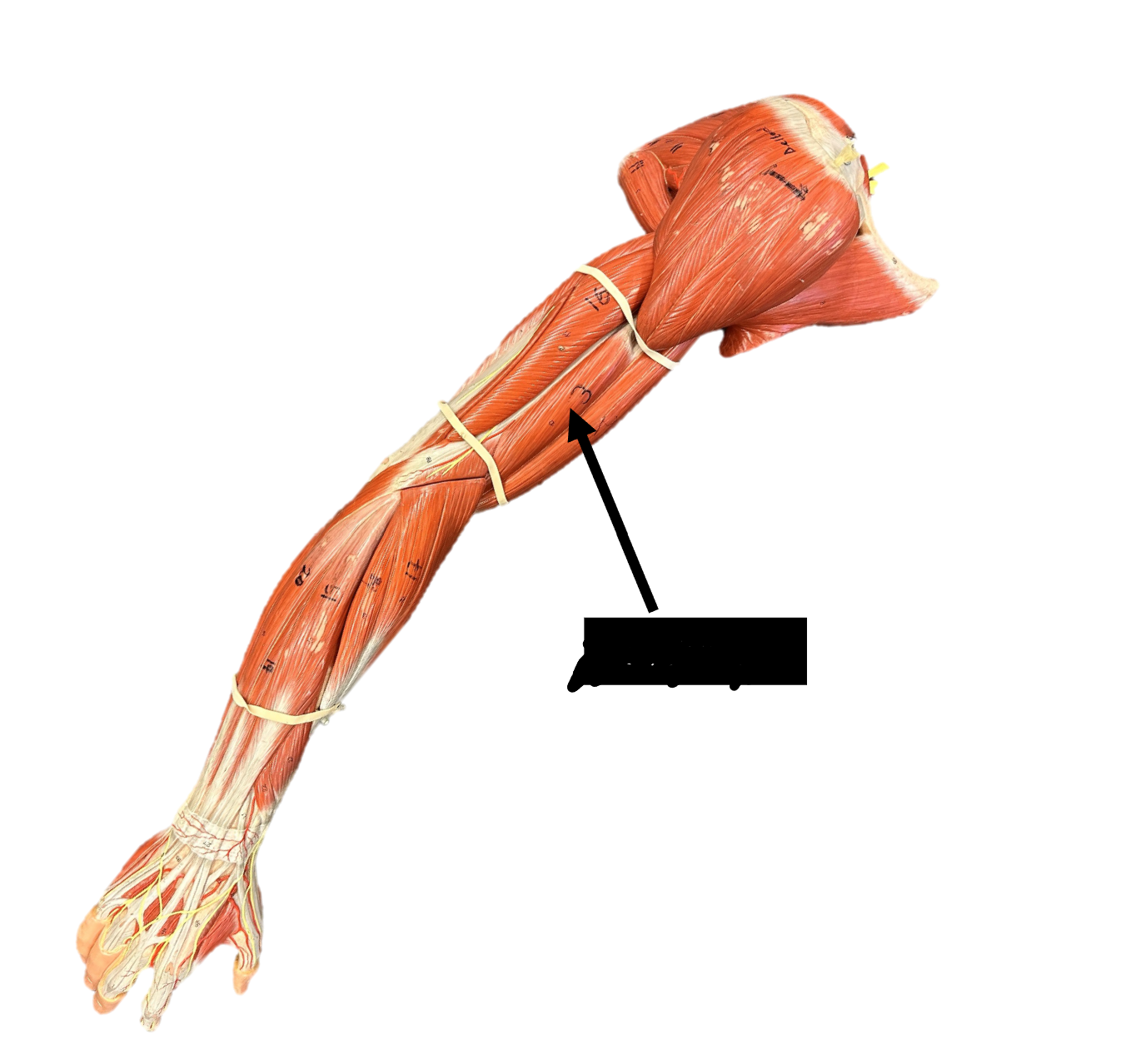 <p>Origin: anterior humerus</p><p>Insertion: coronoid process</p><p>Function: flexes forearm at the elbow joint</p>