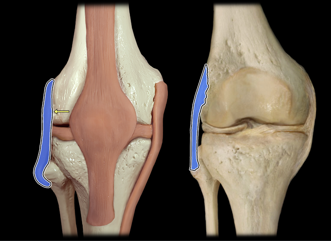 <p>Fibular collateral ligament</p>