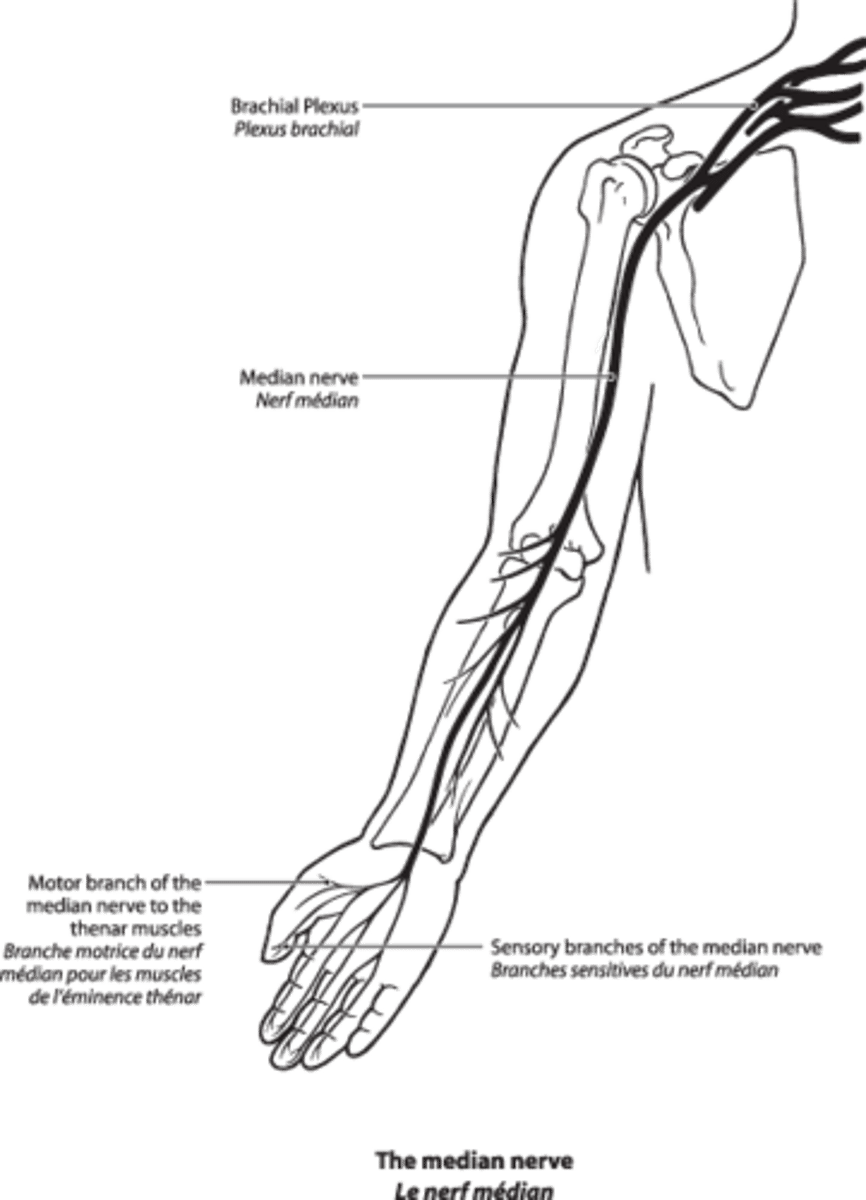 <p>Spinal Roots: C5-T1</p><p>Cause of Injury:</p><p>- proximal lesion = supracondylar fracture of the humerus - distal lesion = carpal tunnel syndrome and wrist laceration</p><p>Presentation:</p><p>- APE hand and Popes Blessing</p><p>- loss of wrist flexion, flexion of lateral fingers, thumb opposition, lumbricals of 2nd and 3rd digits</p><p>- loss of sensation over thernar eminence and dorsal and palmar aspects of lateral 3.5 fingers with proximal lesion</p><p>- Tinnel sign (tinling on percussion) and Phalen sign (compression) in carpal tunnel syndrome</p>