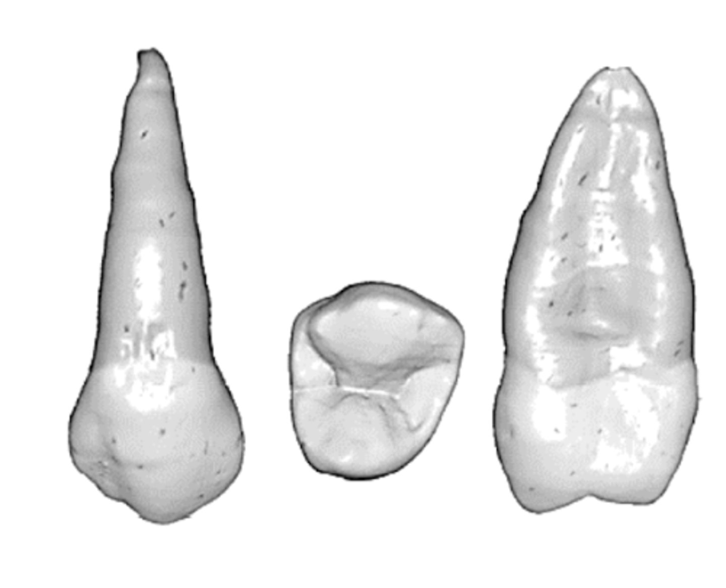 <p>maxillary 2nd premolar</p>
