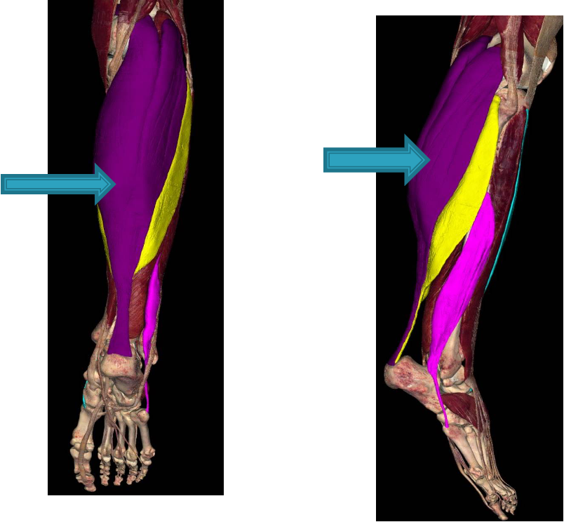 <p><strong>origin:</strong> lateral condyle and medial condyle of femur</p><p><strong>insertion: </strong>posterior surface of calcaneus via achilles tendon</p><p><strong>innervation:</strong> tibial nerve (S1-S2)</p><p><strong>action:</strong> plantar flex ankle when knee is extended, raises heel during walking and flex leg at knee joint</p>