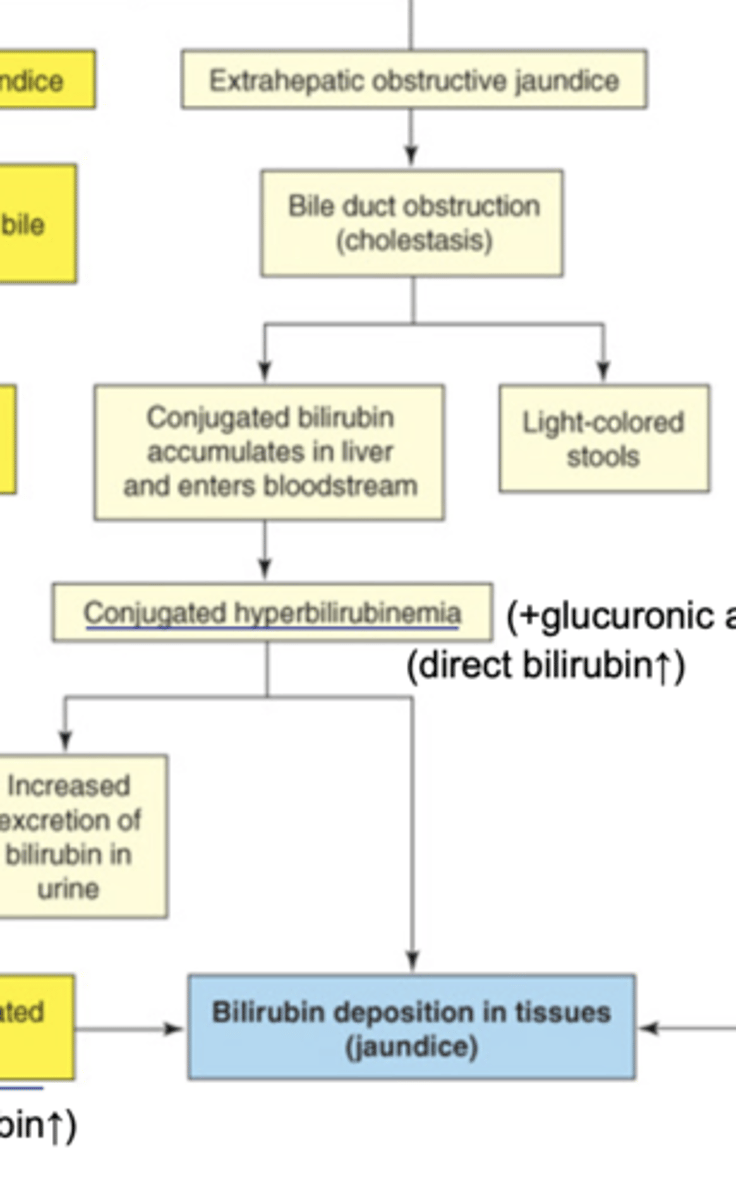 <p>cholestasis (bile duct obstruction)-> conjugated bilirubin in bile is not excreted into SI-> backflow into lymph/blood/tissue= jaundice, light stools, possible more in urine</p>