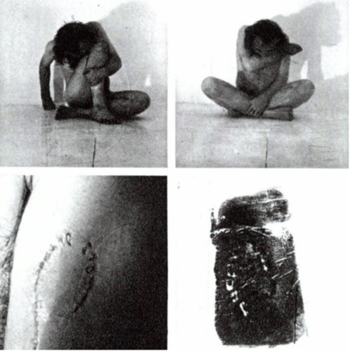 <p>Vito Acconci (Performance Art, Task)</p><ul><li><p><strong>1 Story:</strong> Bites himself to create prints—performance as task, a key 1970s form.</p></li><li><p><strong>2 Changes:</strong> Exemplifies Postminimalism’s emphasis on procedure and body-as-system (Art Since 1900).</p></li><li><p><strong>3 Context:</strong> Responds to interest in self-surveillance and the body in crisis (post-’68 cultural anxiety).</p></li><li><p><strong>4 New Approaches:</strong> Collapses drawing, printmaking, and performance into one conceptual action.</p></li></ul><p></p>