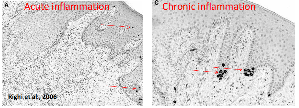 <ul><li><p>will inc in acute inflammation </p></li><li><p>will jump substantially in number in chronic inflammation </p></li></ul><p></p>