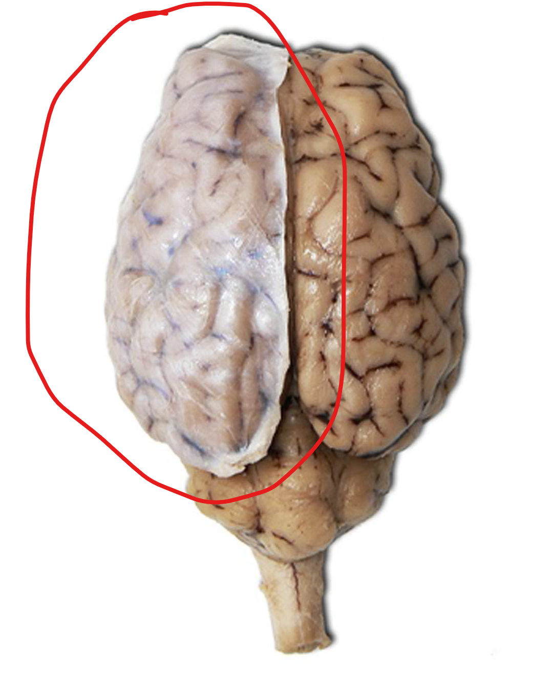 <p>What is the white structure/sheet within the red circle called?</p>