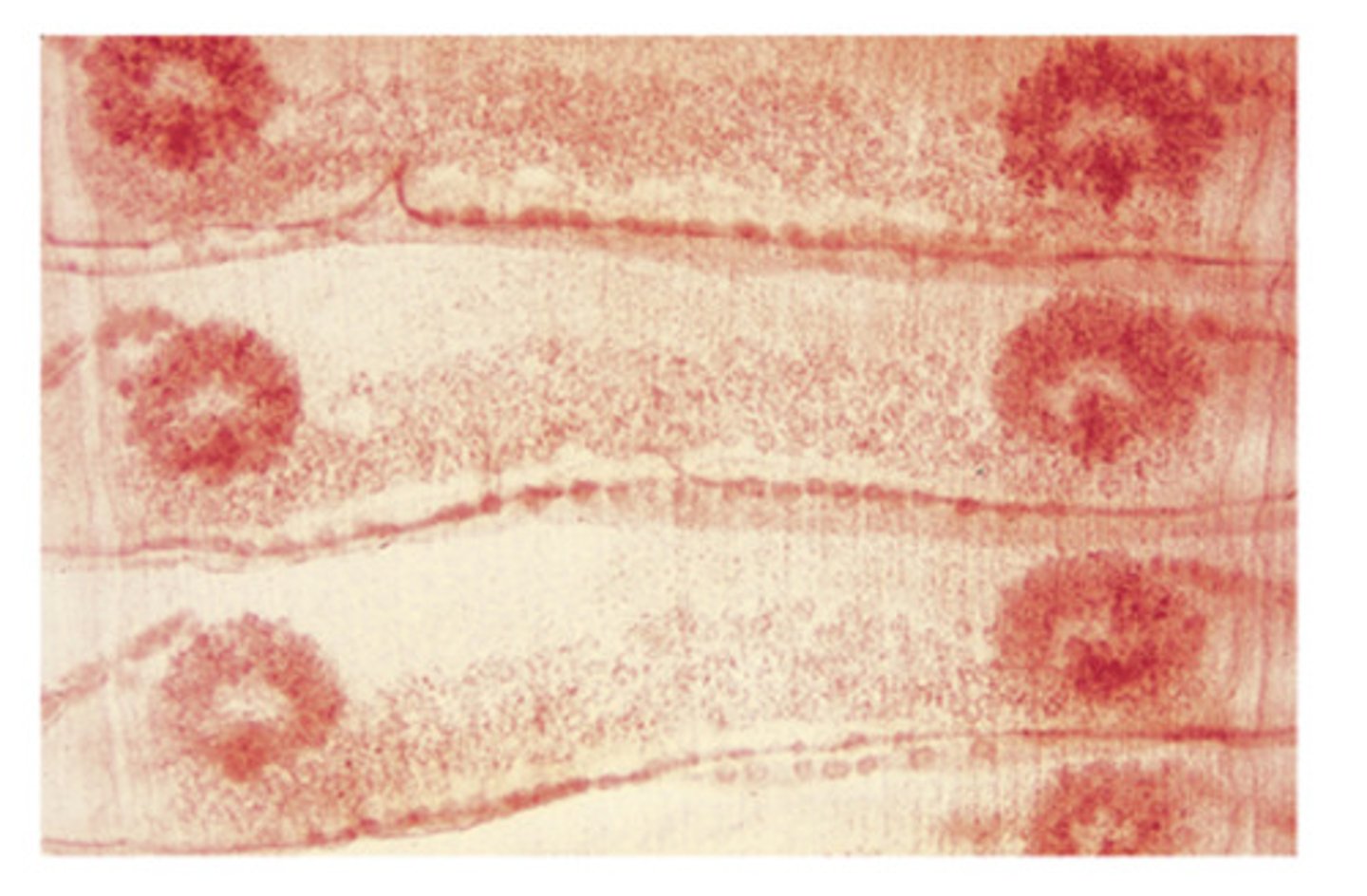 <p>Moniezia species of Cestode that infect goats, sheep, and cattle have laterally located organs in the proglottids. These organs are the</p>