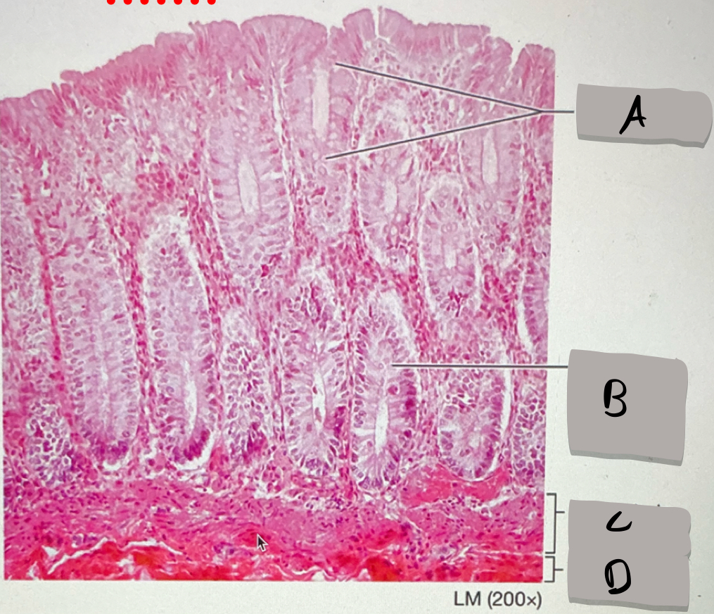 <p>what does this photomicrograph represent ?</p>