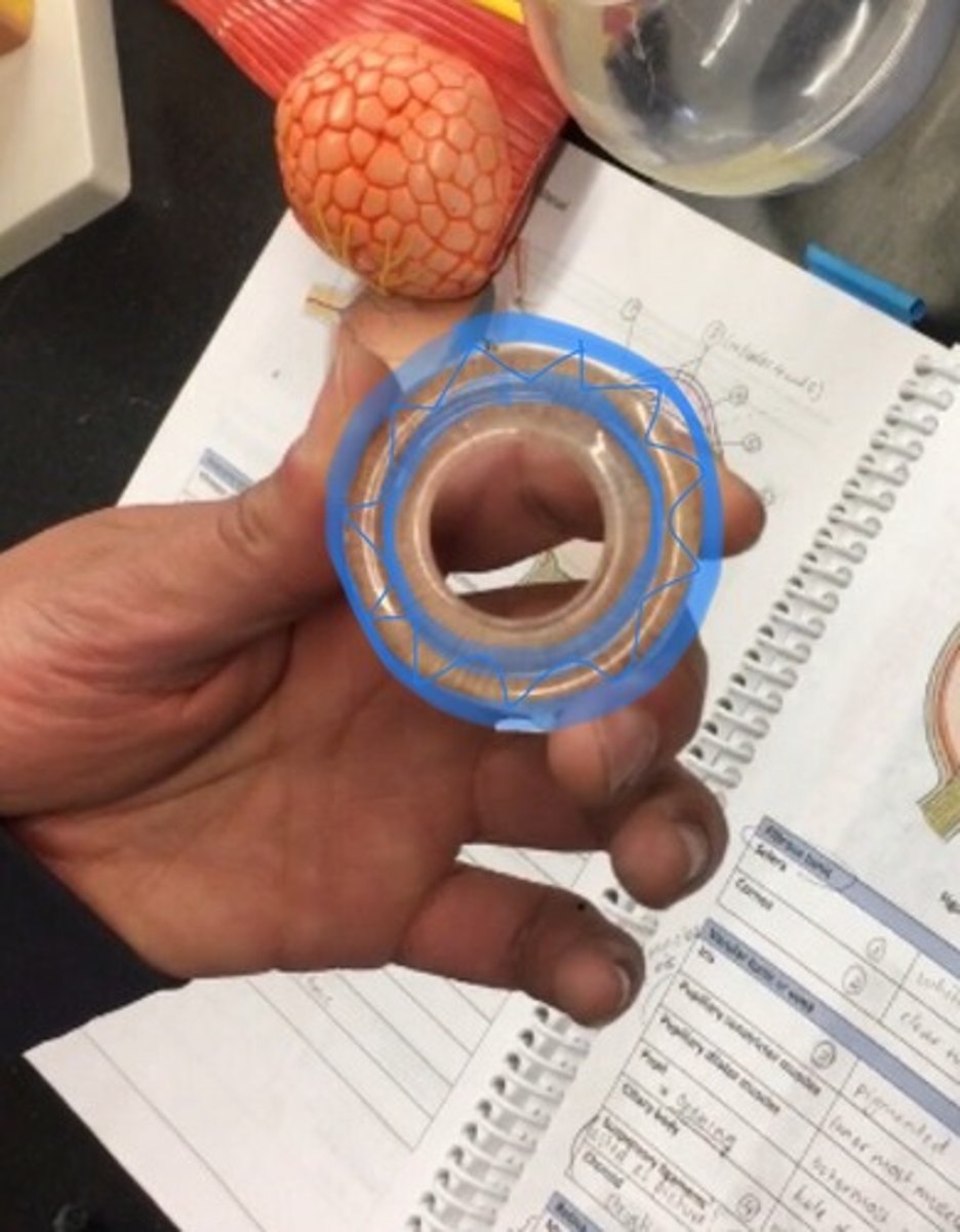 <p>fan like striations on outside (still in iris) the outside ring.</p>