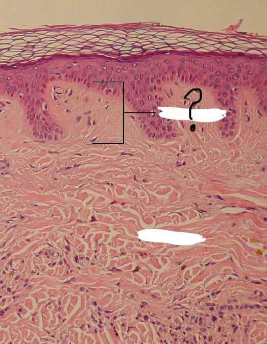 term image
