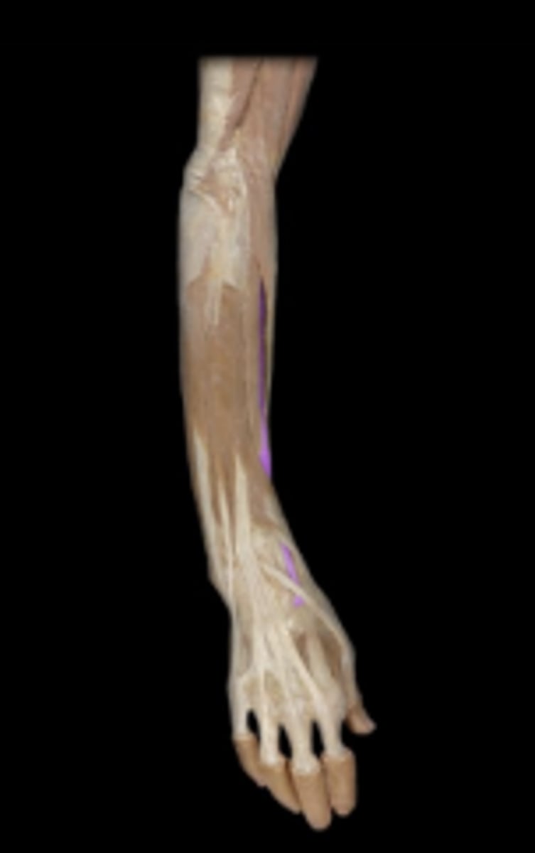 <p>action: extension of wrist and aids in radial flexion of wrist.</p>