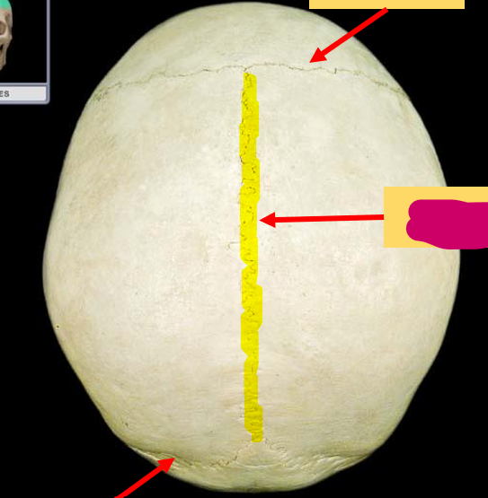 <p>What feature of the skull is this?</p>