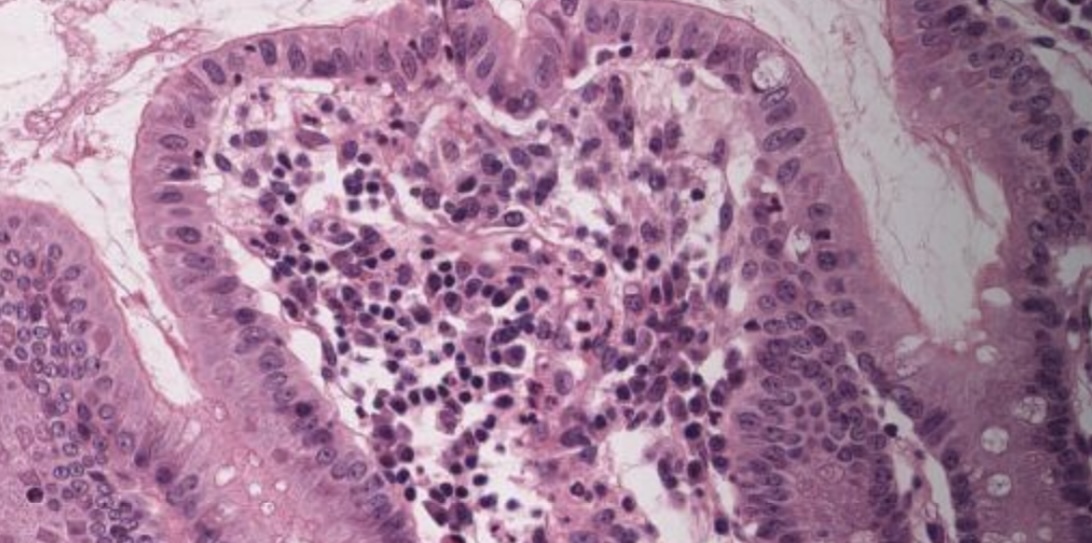 <p>What type of epithelium is this?</p>