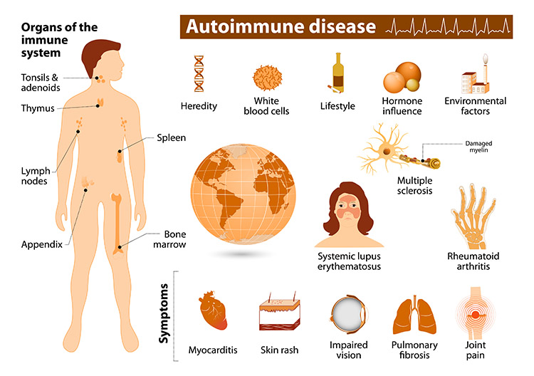 <p>Examples of autoimmune diseases </p>