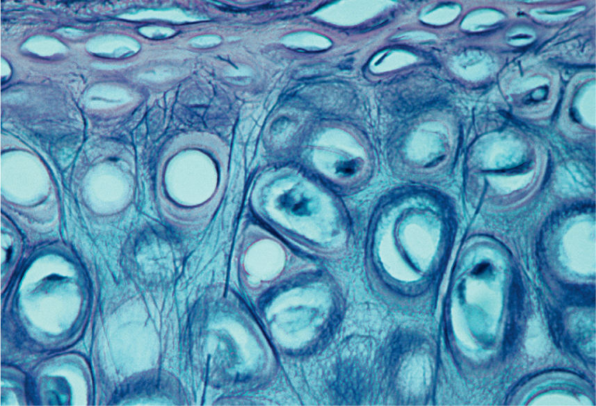 <p><span style="font-family: Calibri">Cartilage containing an abundance of elastic fibers; provides flexible, elastic support; found in the external ear and epiglottis</span></p>