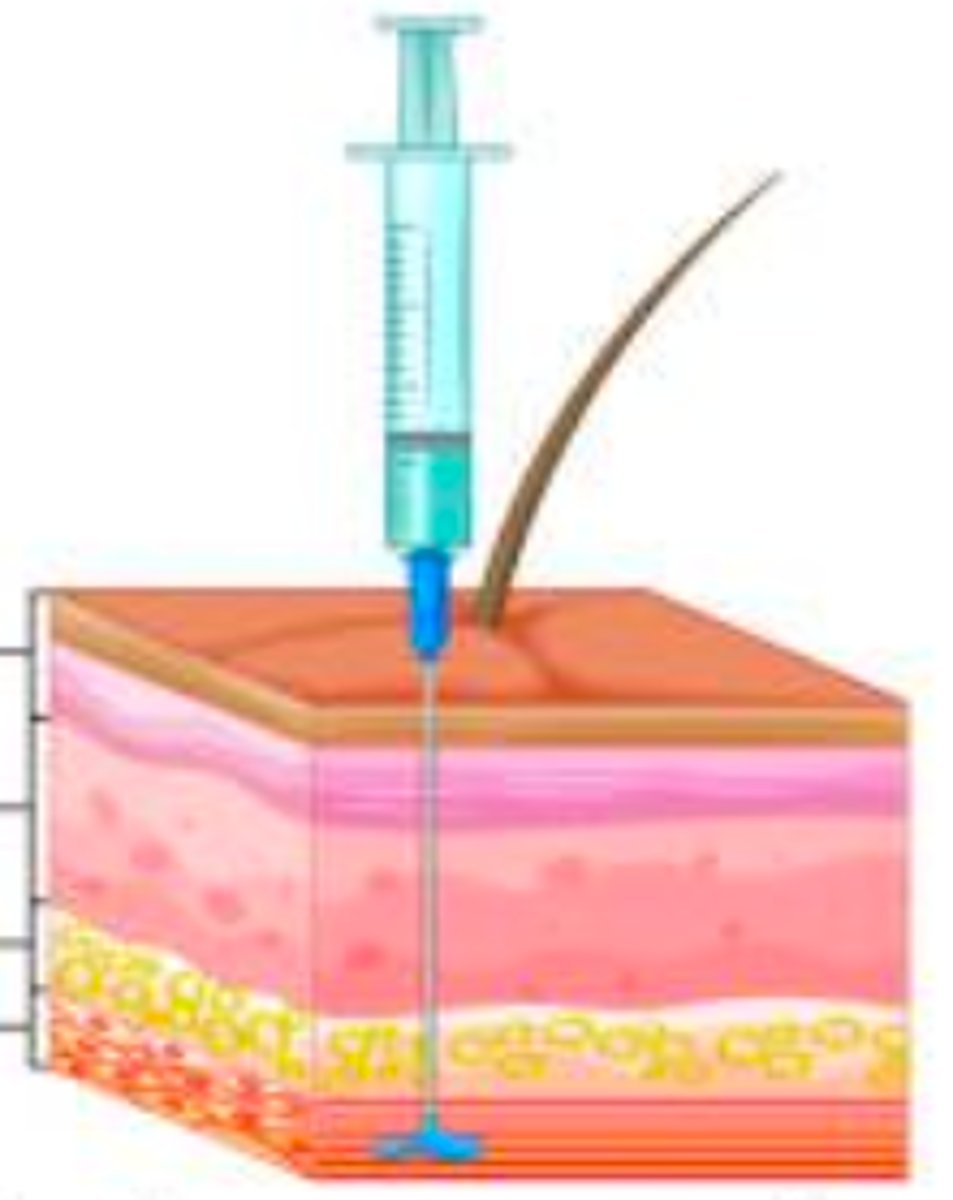 <p>- drug is injected into muscle tissue that lies under subcutaneous layer​</p><p>- rapid onset of action</p><p>- Can damage a blood vessel if injected too deeply into muscle​</p><p>- Sites include deltoid muscle in upper arm and vastus lateralis muscle in the lateral thigh and gluteus maximus in the buttocks​</p><p>- Needle length is 1"-3"</p>