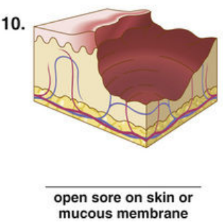 <p><span style="color: red">F Match each of the following lesions with their illustrations in Figure 16-26.</span></p><p></p>