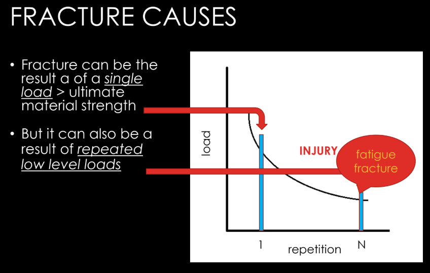 <ol><li><p>result of a single load > ultimate material strength</p></li><li><p>result of repeated low level loads</p></li></ol><p></p>