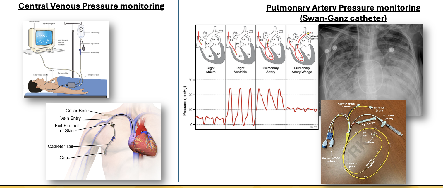 <ul><li><p>Central Venous Pressure Monitoring </p></li><li><p>Pulmonary Artery Pressure Monitoring (Swan-Ganz catheter) </p></li></ul><p></p>