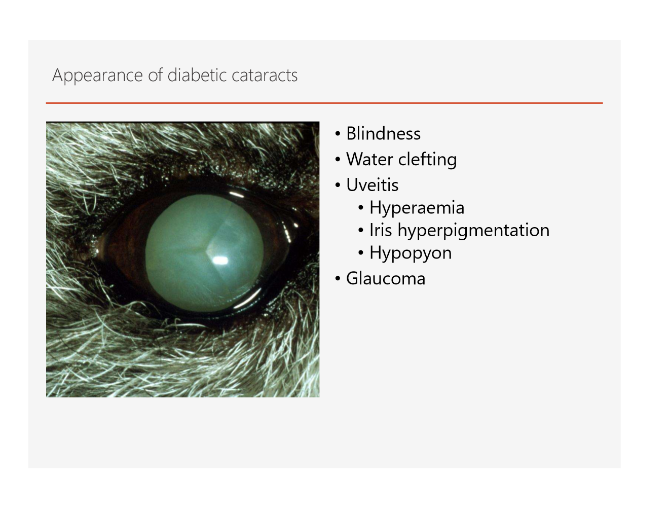 <p>Ultrasound is especially helpful</p><img src="https://knowt-user-attachments.s3.amazonaws.com/8bea7f08-db3b-4015-a460-2540cb53e5fc.png" data-width="100%" data-align="center"><img src="https://knowt-user-attachments.s3.amazonaws.com/6e6c1f47-ddab-4913-8197-9580163cb8b7.png" data-width="100%" data-align="center"><p>diabetic cataract has the hourglass appearance on ultrasound</p>