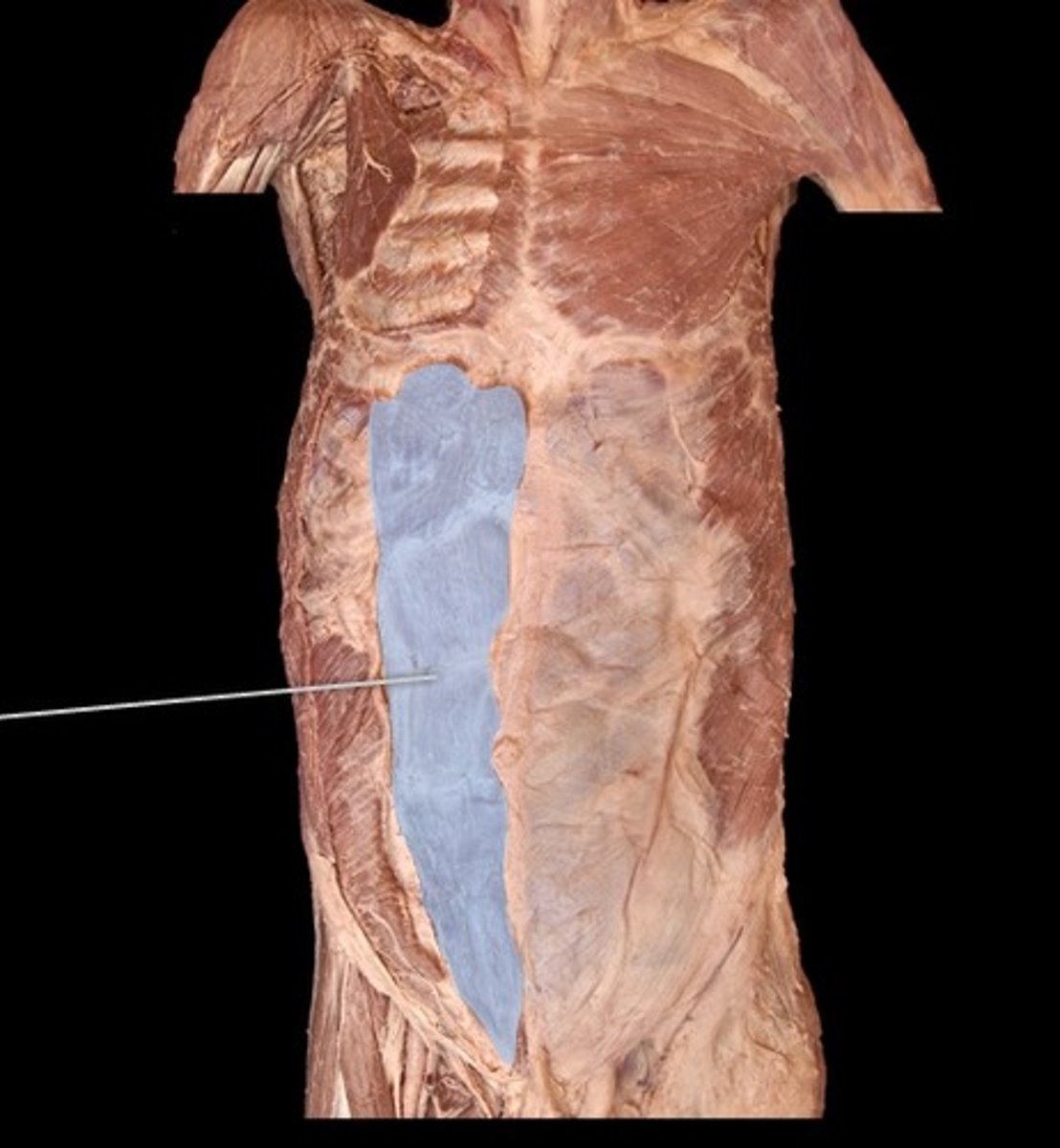 <p>What muscle is this?</p>