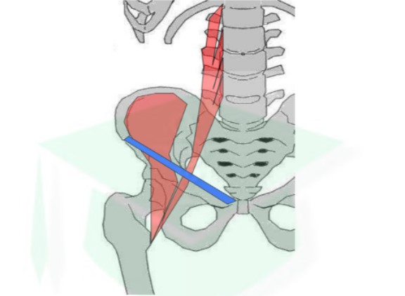 <ul><li><p>trajet : oblique en BAS et en dehors → se lie dans les 2/3 sup au muscle iliaque → devient oblique en bas et en dedans</p></li><li><p>action : fléchir la hanche si point fixe = rachis/bassin ou incliner rachis/bassin si point fixe = fémur</p></li></ul>