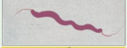 <p>What type of Flagella arrangement is this?</p>
