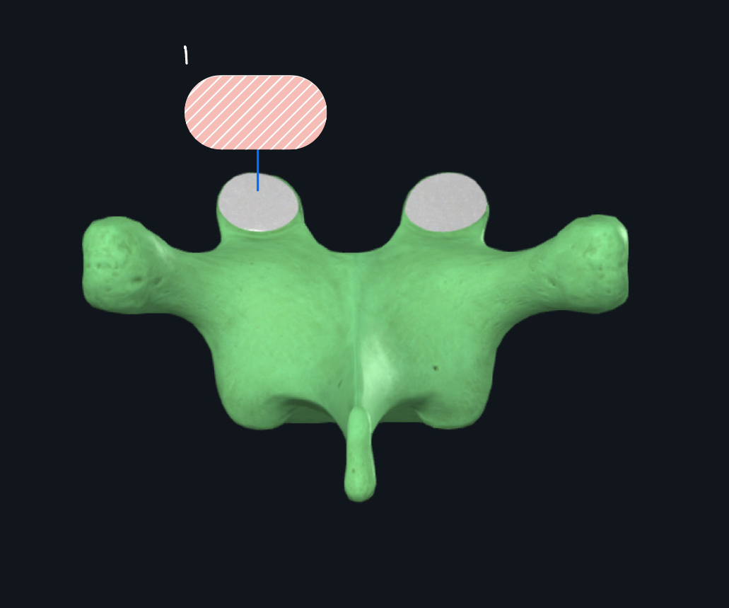 <p>What vertebra is this?</p>
