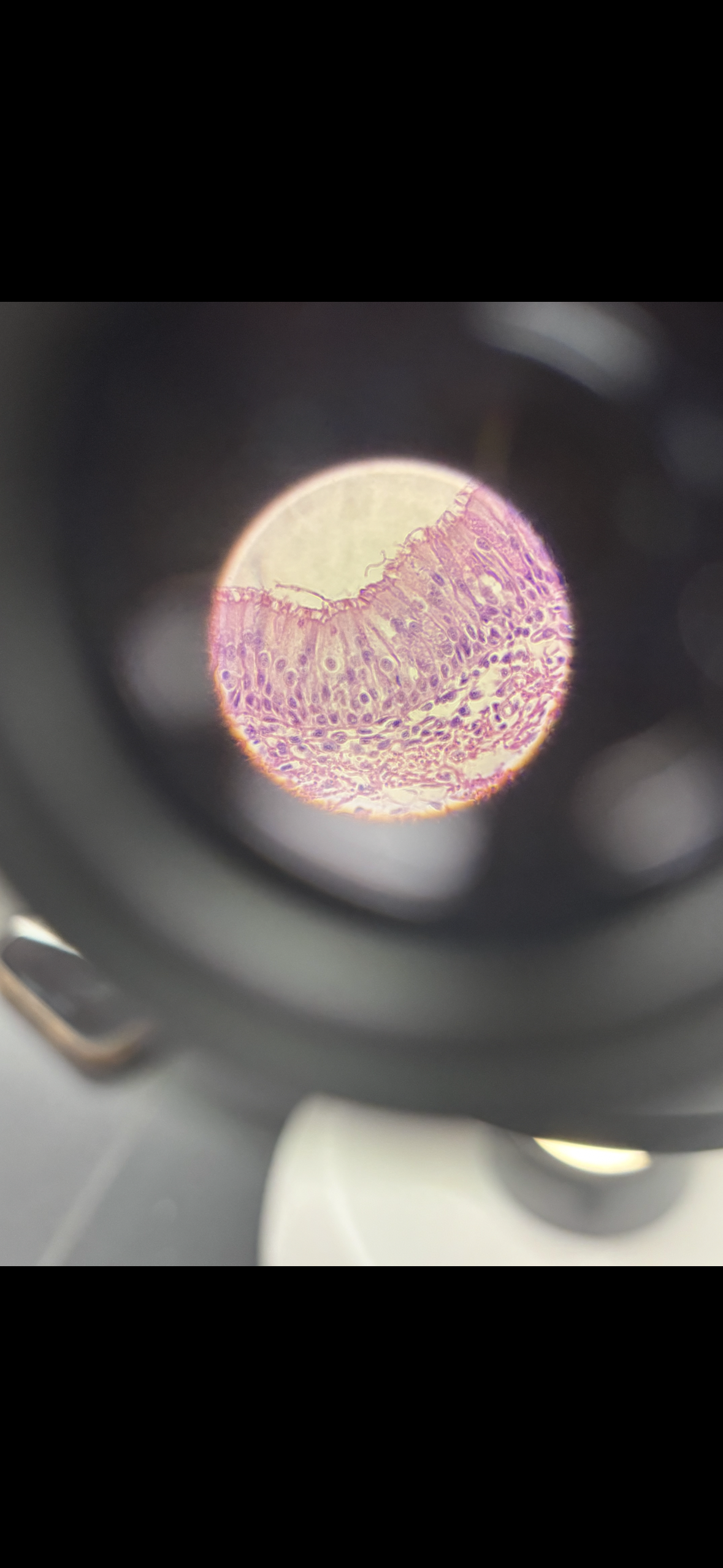 <p>Body location: lining the nasal cavities</p>