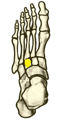 Name the highlighted foot bone