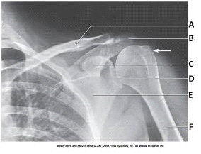 The projection in the image below was obtained with the arm positioned in: