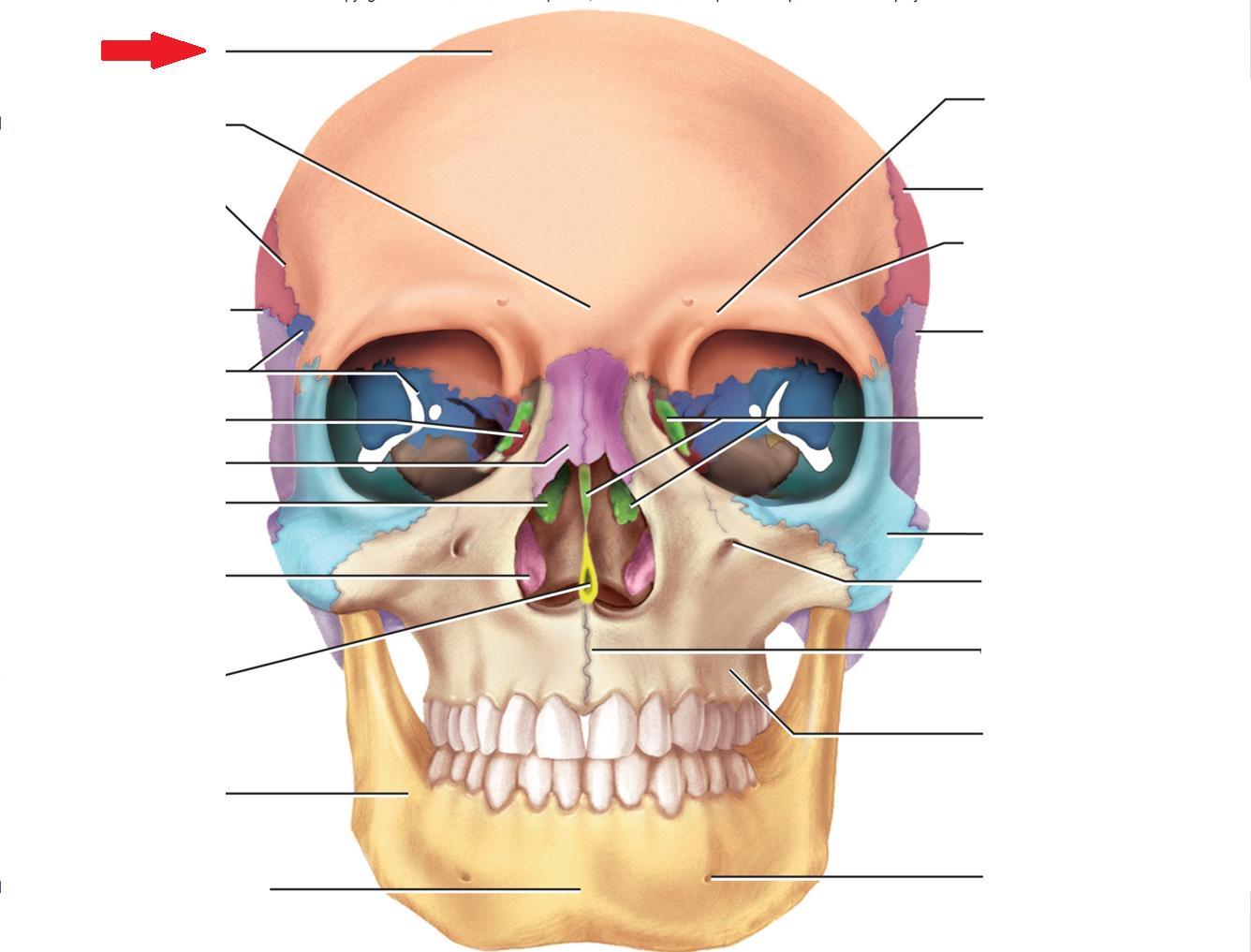 term image