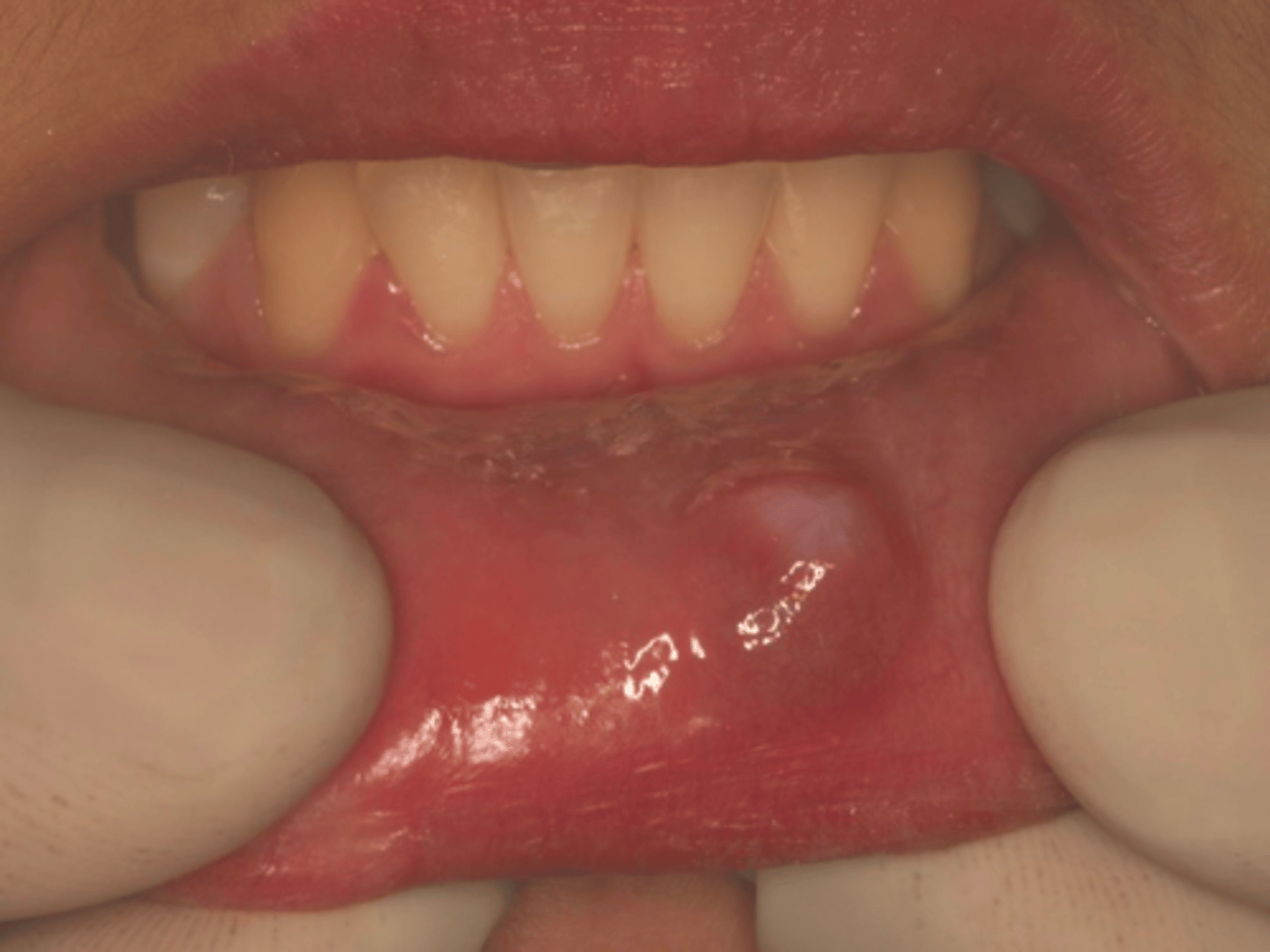 <p>ID the pathology:</p>