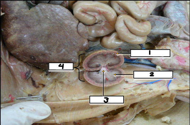 <p>Label structures 1-4</p>