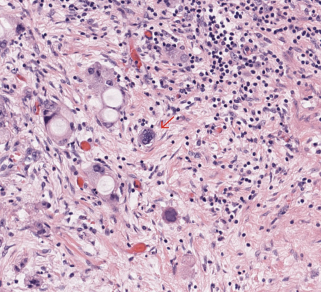 <p>Pancreas</p>