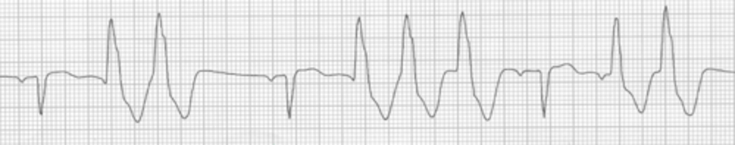 <p>Name the rhythm</p>