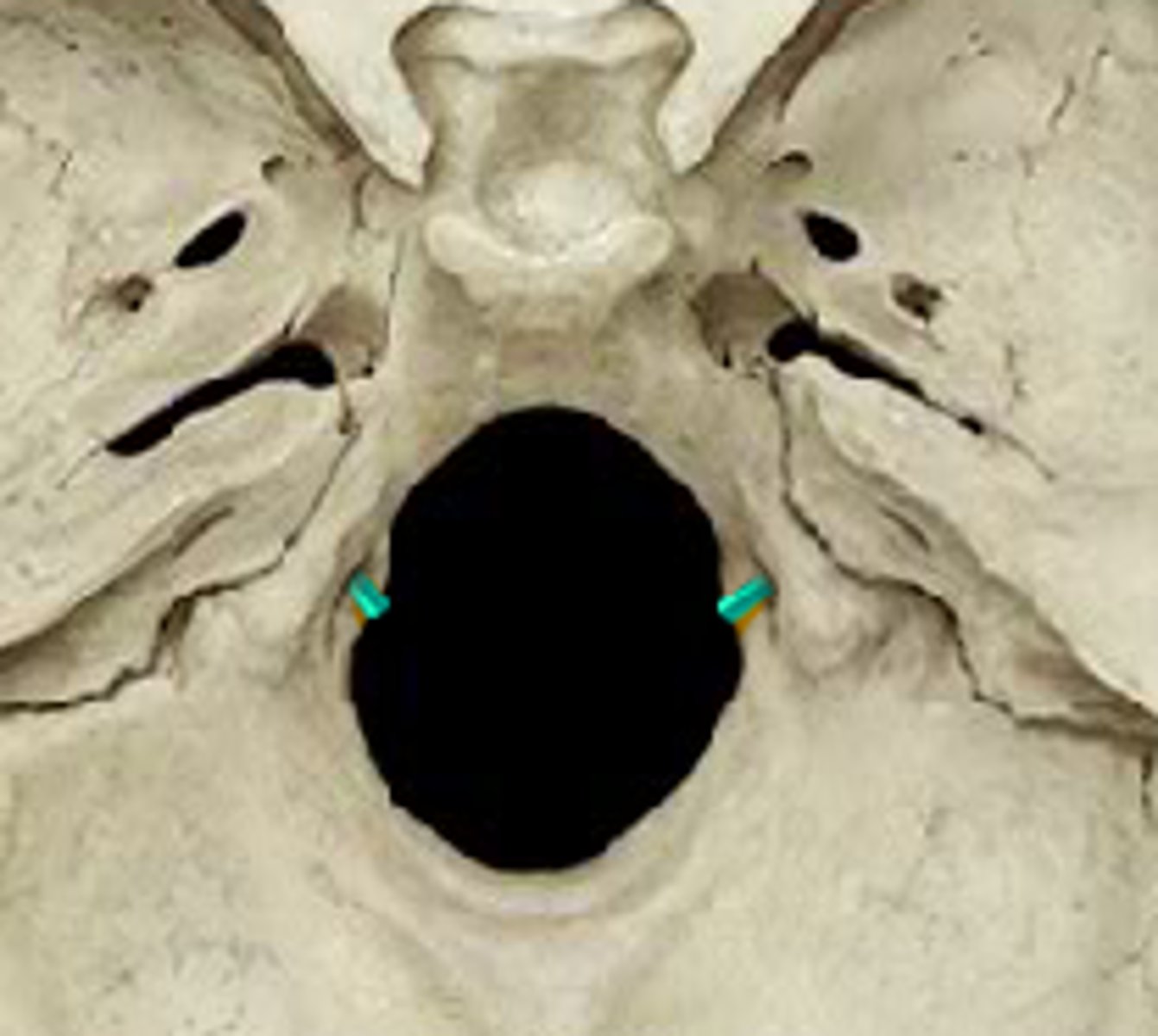 <p>tunnels through the anterior part of the base of each condyle, exit for hypoglossal nerve</p>