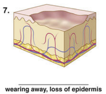 <p><span style="color: red">F Match each of the following lesions with their illustrations in Figure 16-26.</span></p><p></p>