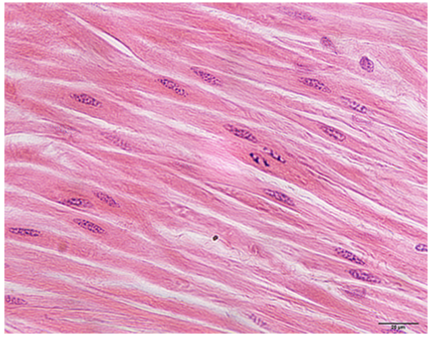 <p>What muscle is this?</p>