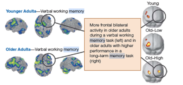 <p>Bilateral Activation: </p>