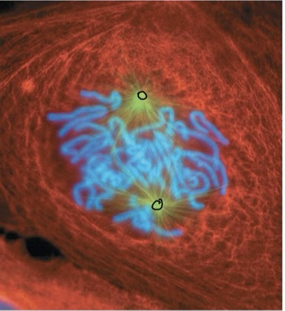 <p>Prometaphase</p>