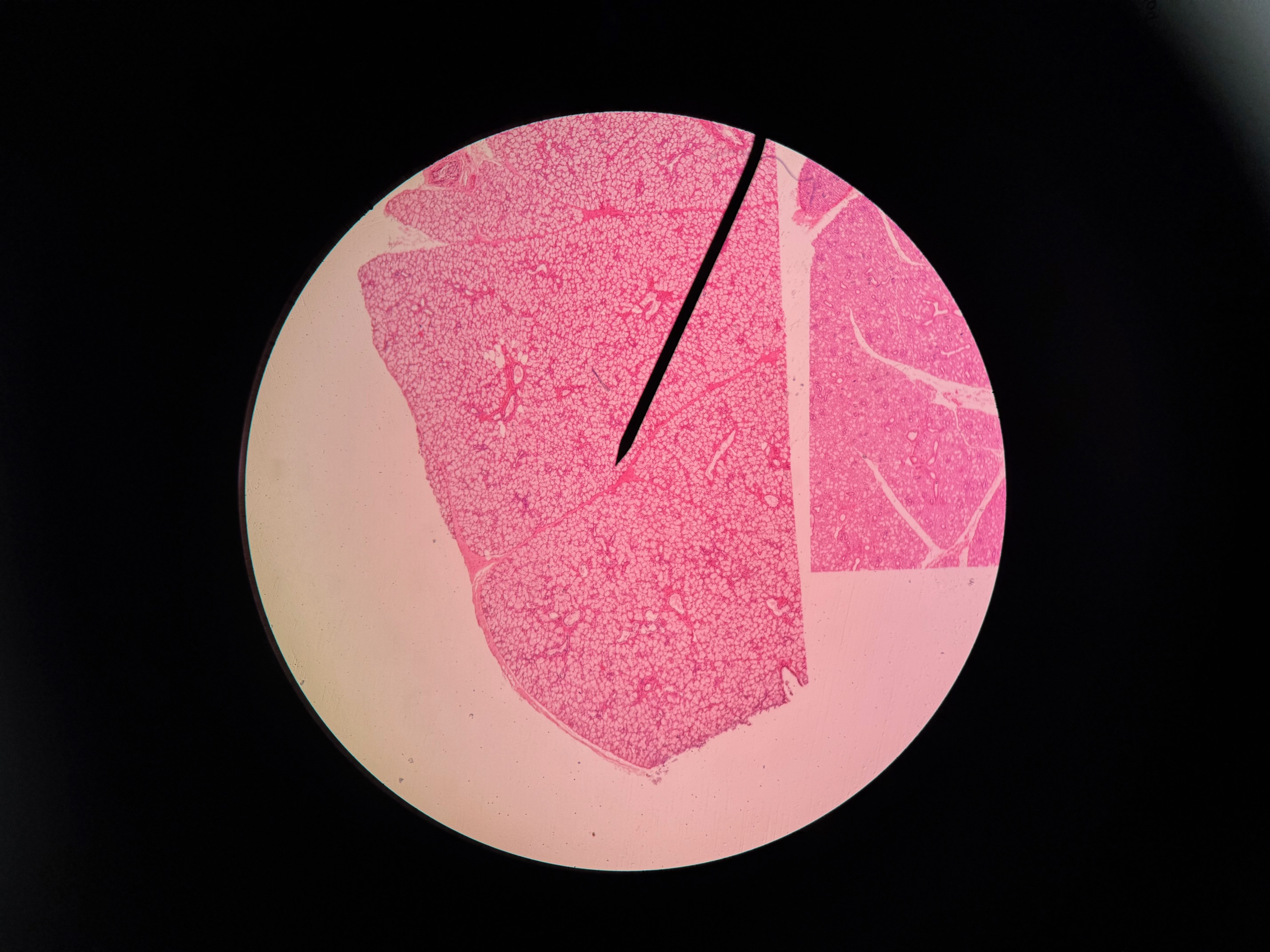 <p>Organ?</p>