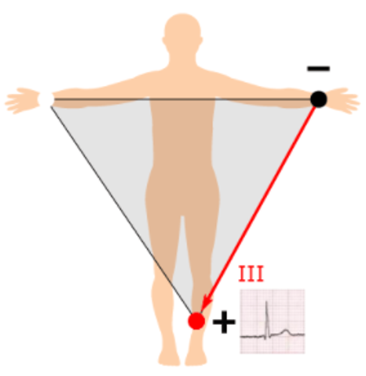 <p>From the left arm to the left leg with the positive electrode being at the left leg, at 120°</p>