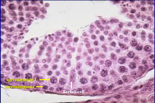 <p>Canine seminiferous tubule. </p><p>The <strong>seminiferous tubule</strong> is lined by a <strong>stratified epithelium </strong>composed of <strong>Sertoli cells</strong> and <strong>spermatogenic cells. </strong></p><p>A <strong>Sertoi cell </strong>is basically columnar with an oval euchromatic nucleus with prominent nucleolus. </p><p>The basal layer of spermatogenic cells is composed of <strong>spermatogonia</strong>. </p><p>The next layer of cells contain large nuclei with thick chromosomes these are the <strong>primary spermatocytes. </strong></p><p>Toward the luminal side (top) are several layers of cells in more advanced stages of development - the secondary spermatocytes and spermatids</p>